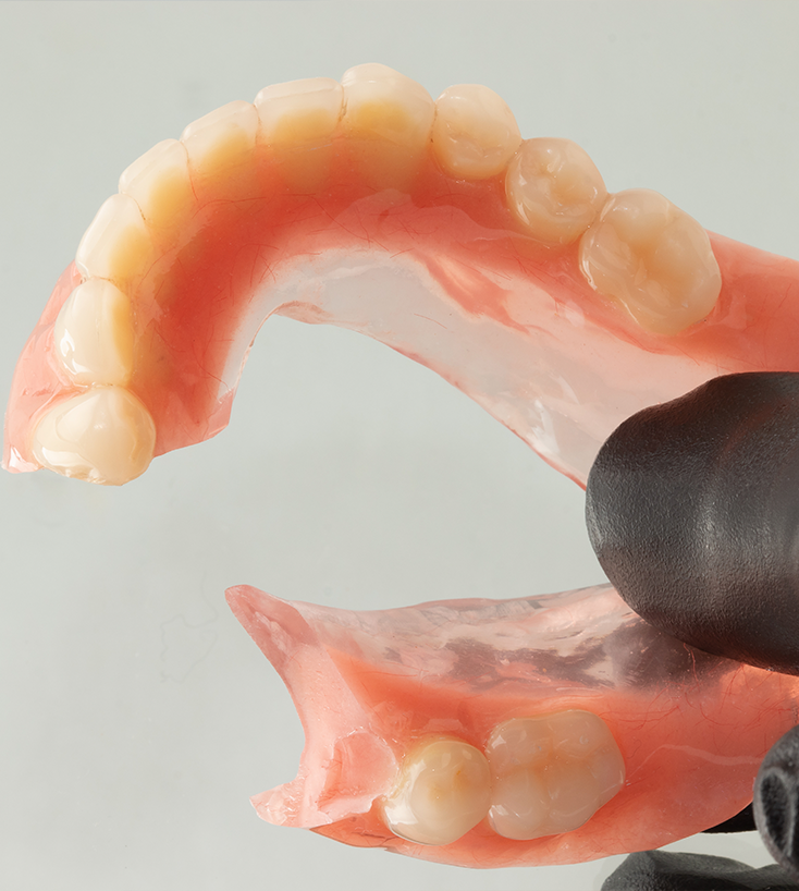 Prótese parcial flexível vista de perto, mostrando base rosada e dentes