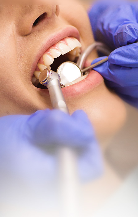 Limpeza dentária