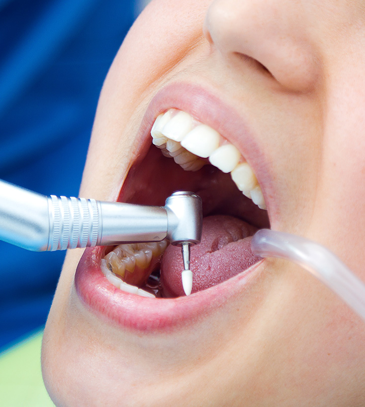 Modelo odontológico e sorriso saudável após atendimento preventivo