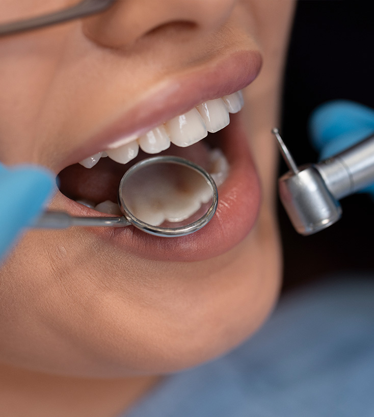 Modelo odontológico e o sorriso do paciente após o tratamento