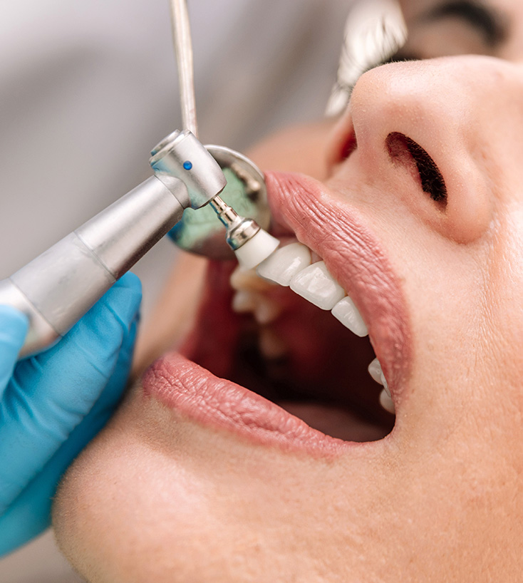 Atendimento odontológico preventivo sendo realizado com instrumento específico