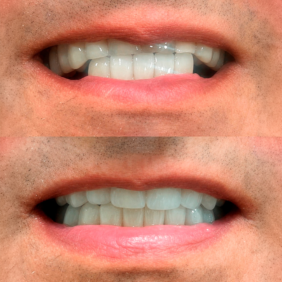 Registro clínico de antes e depois de tratamento odontológico