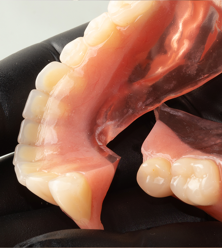 Detalhe de prótese parcial flexível com dentes e base translúcida